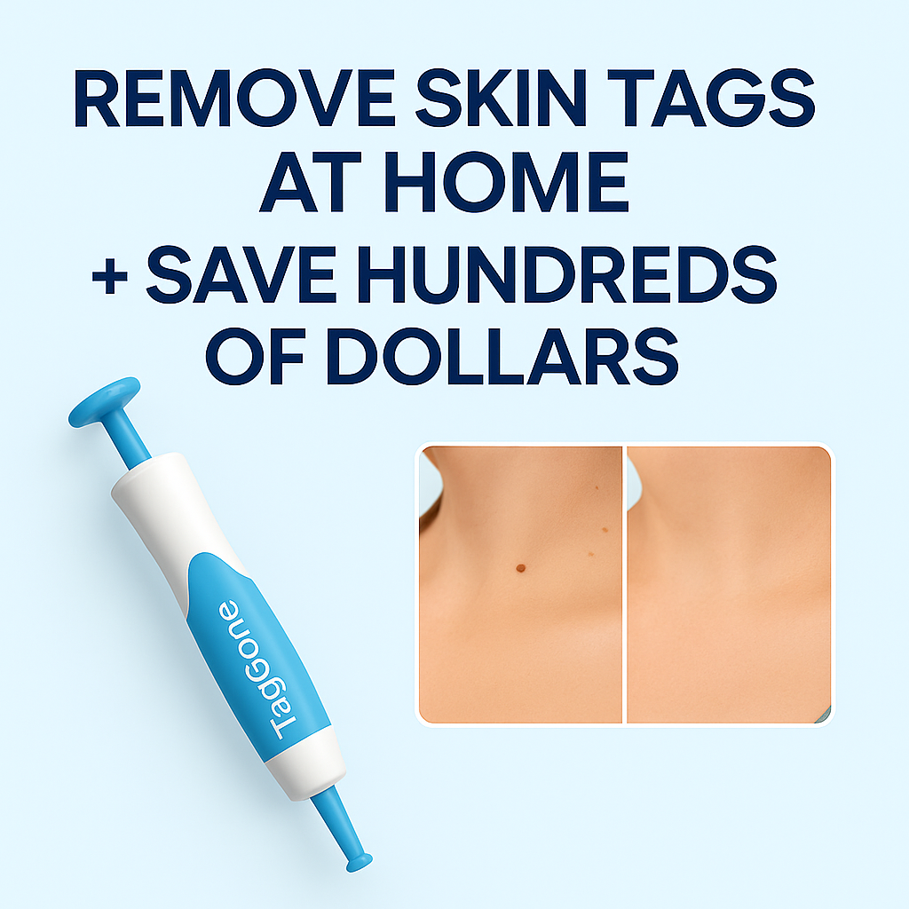 TagGone™ - Permanantly Remove Skin Tags At Home